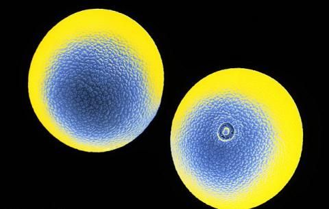 顯微鏡下結構奇特的花粉3D圖片(圖)