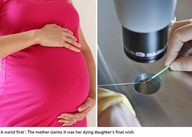 史上首例！取亡女冷凍卵子 外婆懷孫（圖）