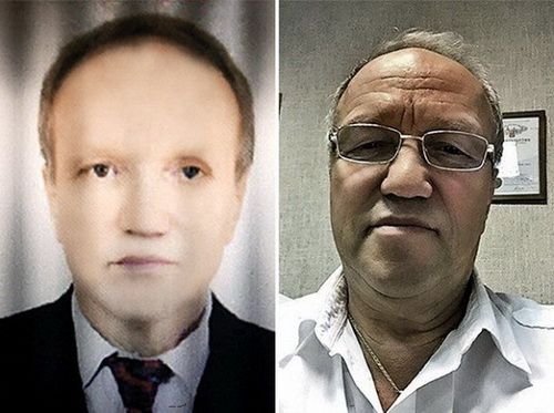 俄男移植非裔肝脏后白变黑